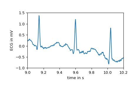 ../../_images/scipy-datasets-electrocardiogram-1_00_00.png