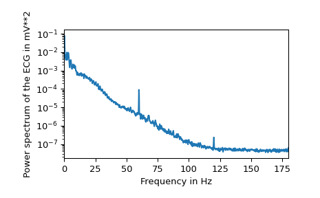 ../../_images/scipy-misc-electrocardiogram-1_03_00.png