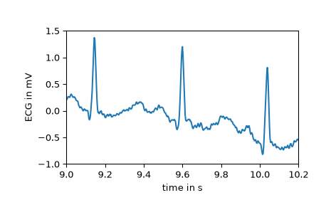 ../../_images/scipy-datasets-electrocardiogram-1_00_00.png
